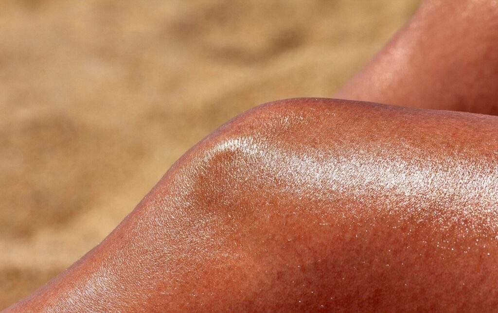 coup de soleil grave traitement urgence – peau brûlée rouge