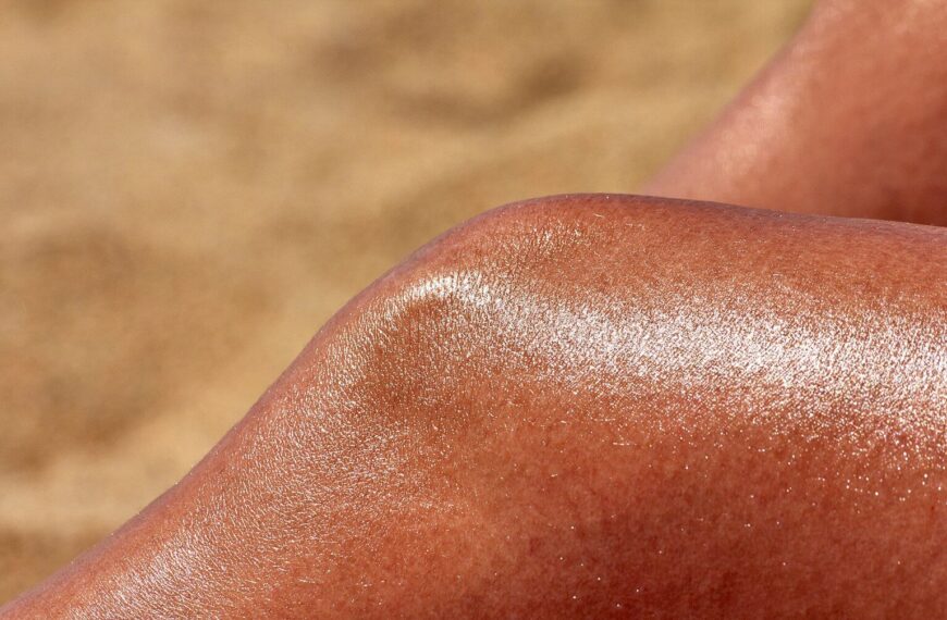 coup de soleil grave traitement urgence – peau brûlée rouge